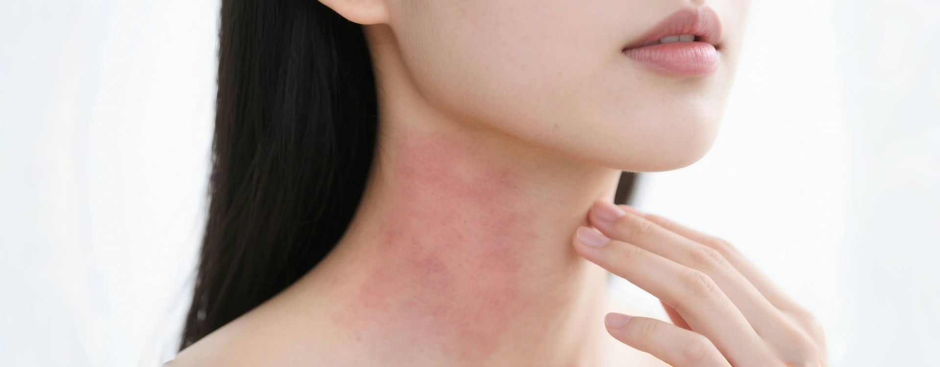 红光能否缓解湿疹症状？